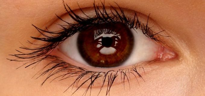 Astigmatism